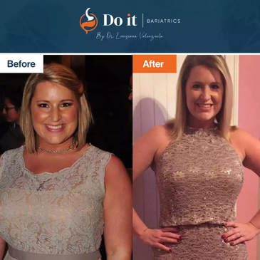 Slider image (3) Do It Bariatrics